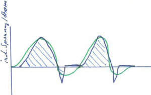 Comparing Medithera to QRS Quantron - ElectroMeds