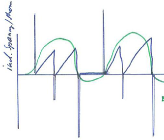 QRS wave form