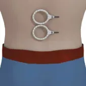 Lower back coil placement 2
