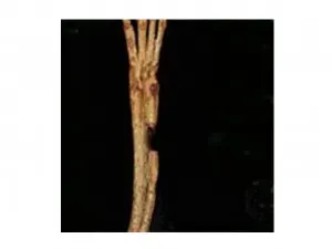Rabbit ulna 28 days without PEMF