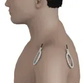 Shoulder coil placement opposite