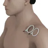 Shoulder coil placement