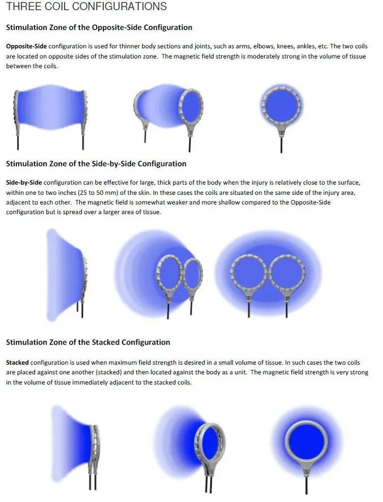 StemPulse single-coil and dual-coil placement diagram