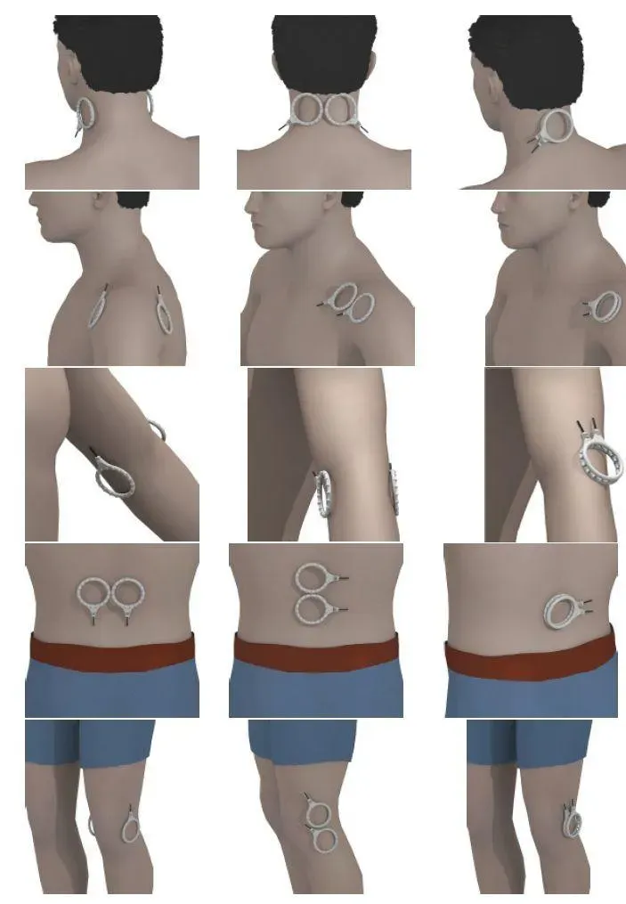 StemPulse PEMF coil placement guide — neck, shoulder, elbow, lower back, knee