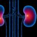 kidney disease Acute pyelonephritis ElectroMeds